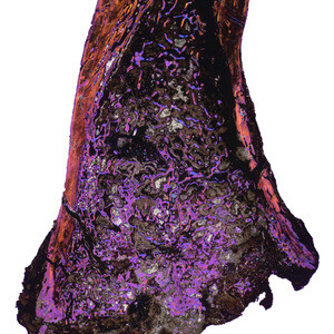 Media type: image; Vertebrate Paleontology 101552 Description: Image shows the histology of a femur from Greererpeton burkemorani in longitudinal section.;