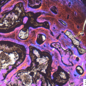 Media type: image; Vertebrate Paleontology 101552 Description: Image shows high magnification of the endosteal surface of a femur cut in transverse section of a Greererpeton burkemorani.;