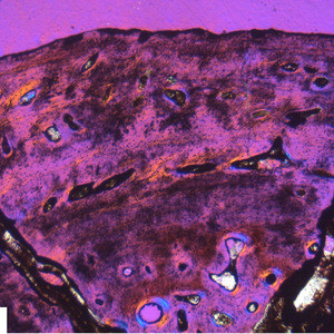 Media type: image; Vertebrate Paleontology 101552 Description: Image shows high magnification of cortex of a femur cut in transverse section of a Greererpeton burkemorani.;