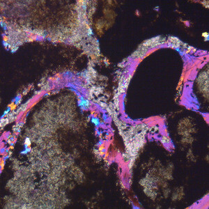 Media type: image; Vertebrate Paleontology 101550 Description: Image shows high magnification of the distal portion of a longitudinal section of the femur of Greererpeton burkemorani. This image highlights trabeculae and calcified cartilage.;
