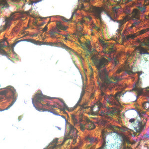 Media type: image; Vertebrate Paleontology 101557 Description: Image showing high magnification of the endosteal ring under polarized light and a lambda filter of a femur from Greererpeton burkemorani.;